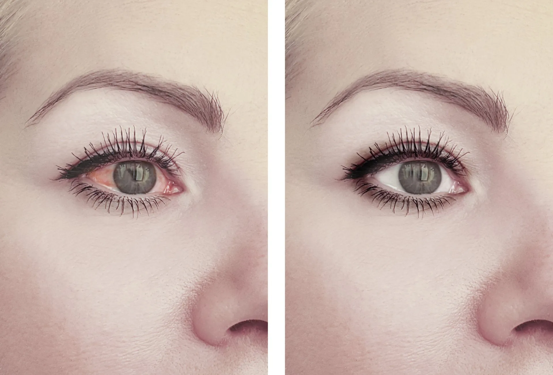 BG Oculistica